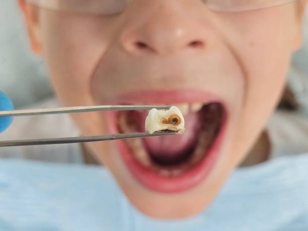 Best Pediatric Emergency Dentist in South Henderson, NC